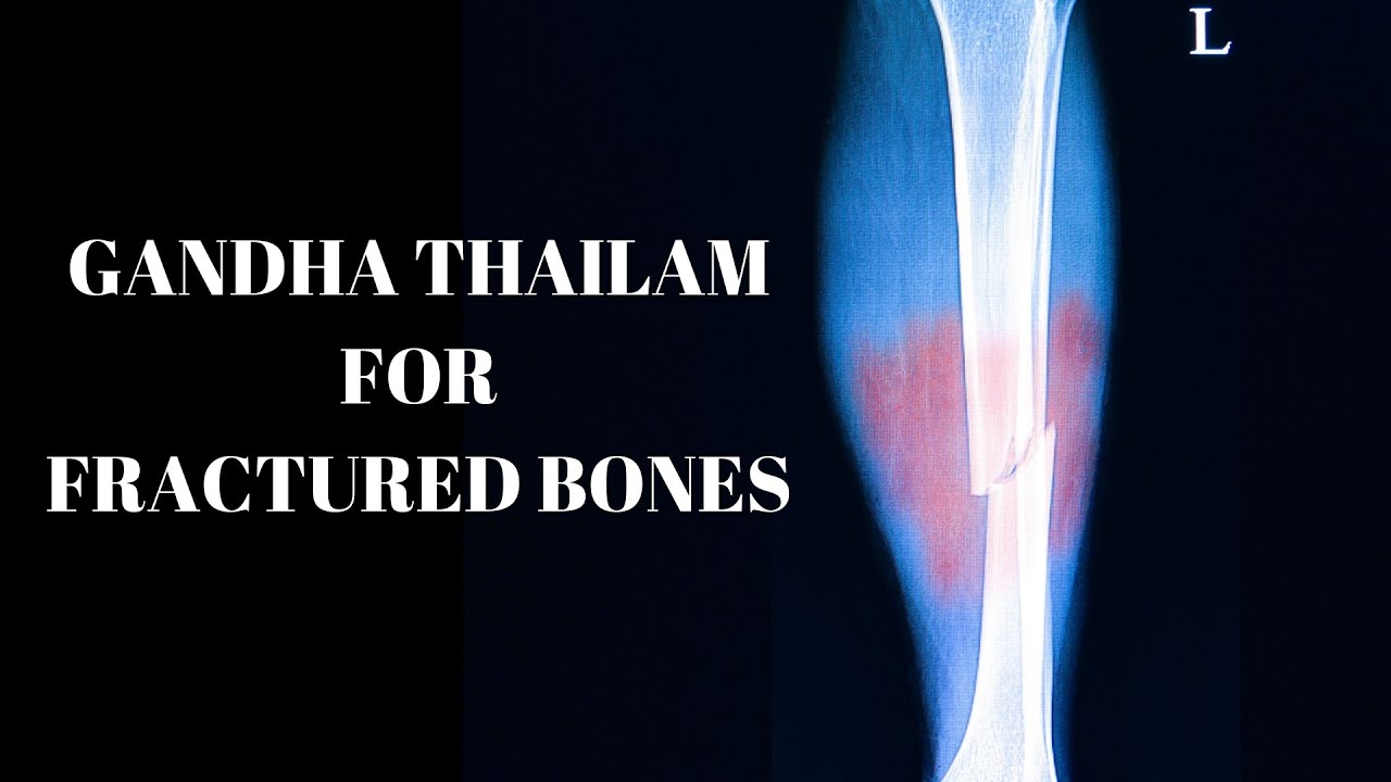 Gandha Thailam  - Indications, ingredients, dosage etc