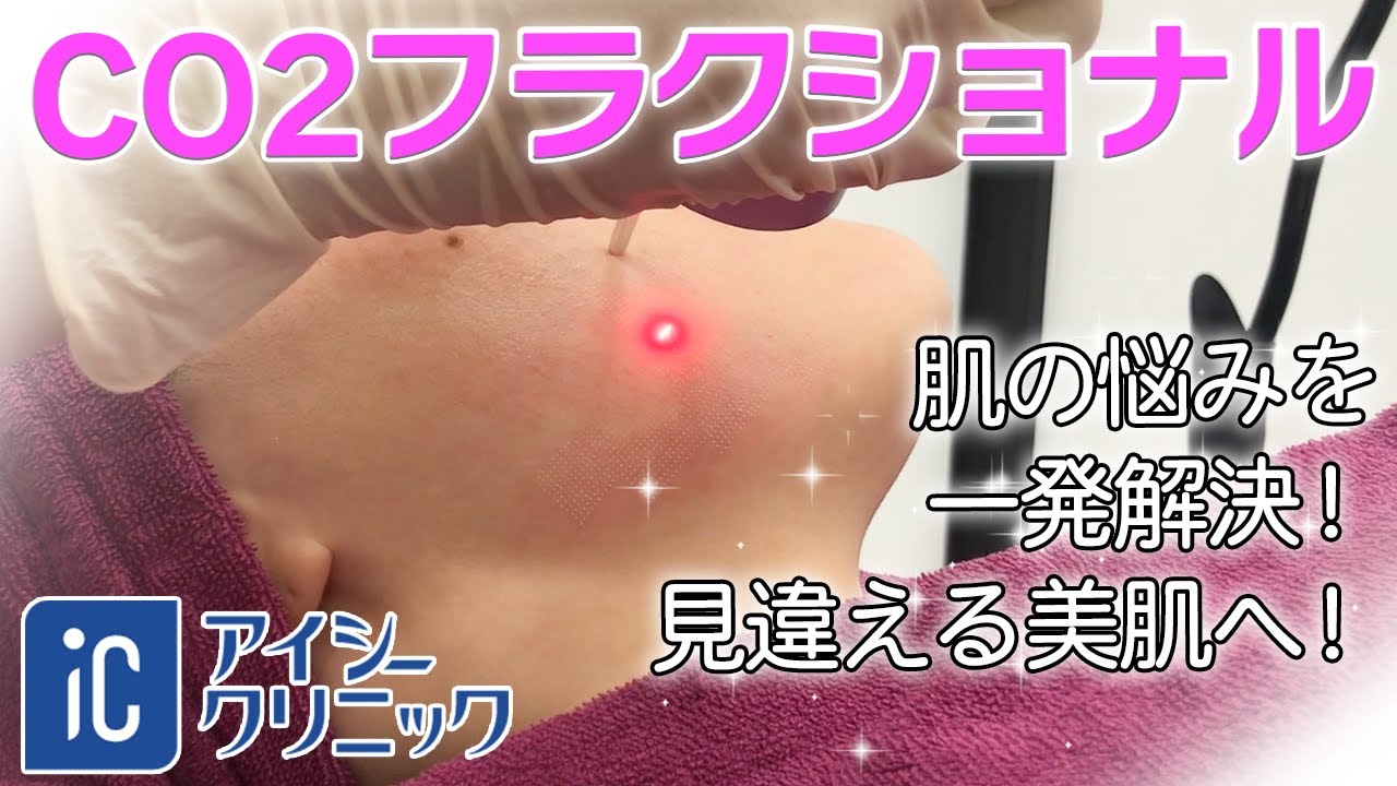 CO2フラクショナル 施術動画 アイシークリニック