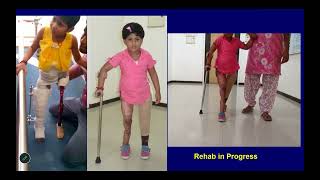 Improving Outcomes in Polytrauma | G-TRACC (2026)