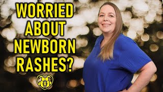 RASHES IN BABIES & NEWBORNS | HOW TO TREAT | HOW TO AVOID | WHEN TO WORRY ABOUT NEWBORN RASHES