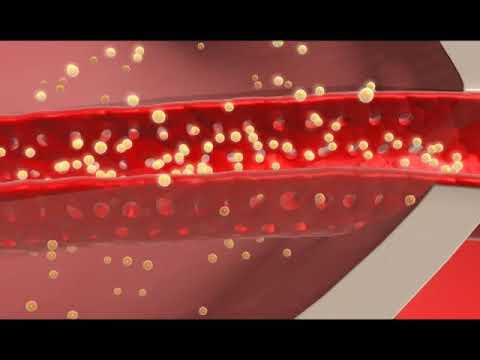 Microvascular Interventional Localised (Intra-arterial) Chemotherapy fuda cancer hospital