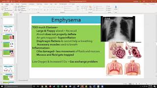 Respiratory: Emphysema