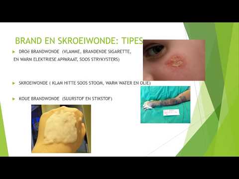 GASVRYHEIDSTUDIE GRAAD 10: 26 Mei 2020 - periode 3 (26103)