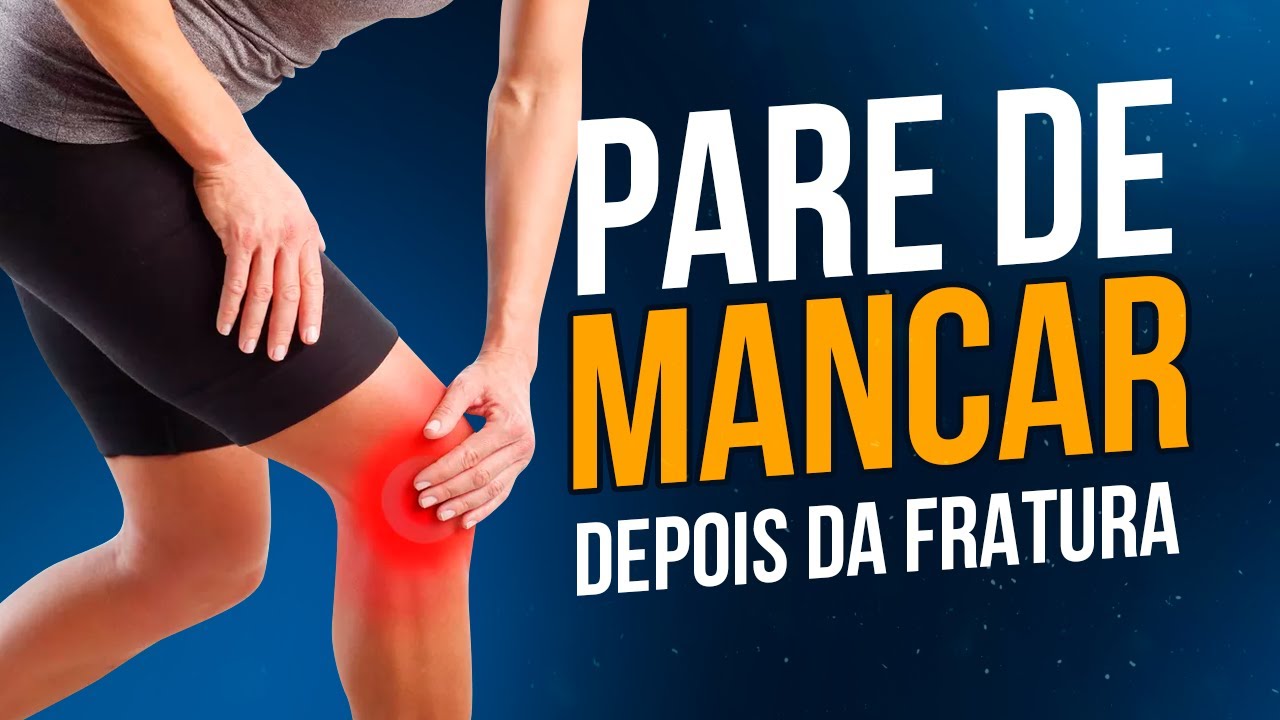 COMO PARAR DE MANCAR DEPOIS DA FRATURA DO MEMBRO INFERIOR?