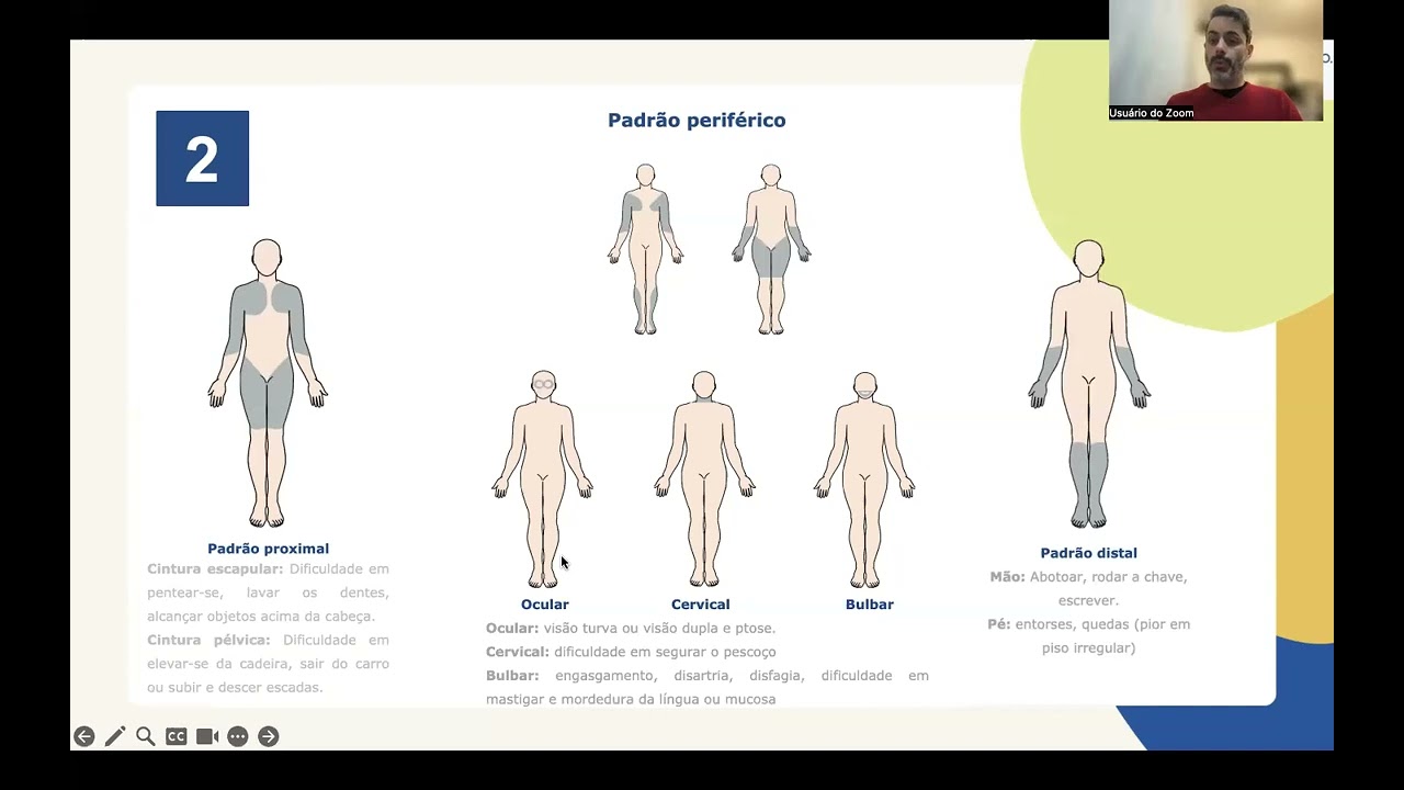Sessão multidisciplinar - Falta de força