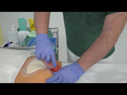 A kezelés az 1. típusú diabétesz izrael