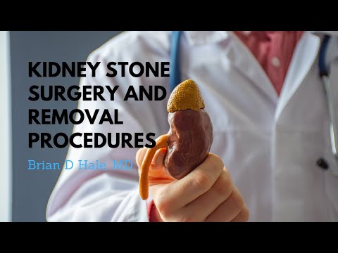 Kidney Stone Surgery & Removal Procedures – Dr. Brian D. Hale