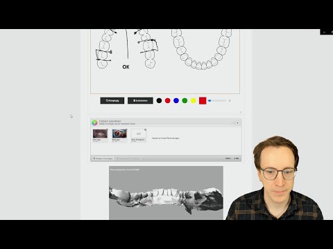KFO Software | Kieferortopädie | KFO Dentallabor | Abrechnung | Intraoral Scan | Digitaler Workflow
