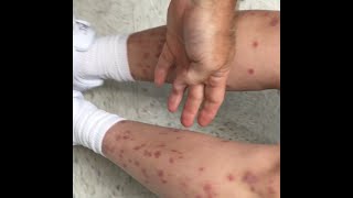 What On Earth Does Molly Have?