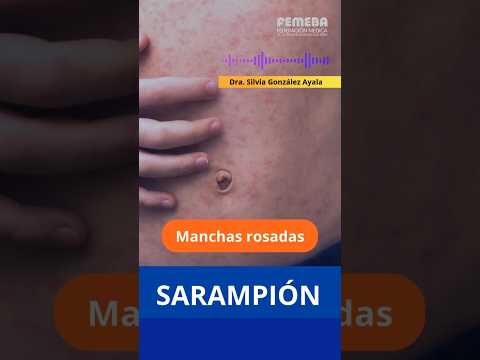 👉Prevención del sarampión por la Dra. Silvia González Ayala. FEMEBA 2026