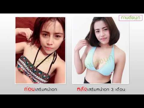 แก้ไขหน้าอกเล็ก หน้าอกเล็กว่าผู้ชายคิดว่า