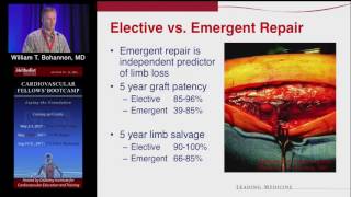 Download Lagu Lower Extremity Aneurysms (William T. Bohannon, MD) August 20, 2016 Thumbnail