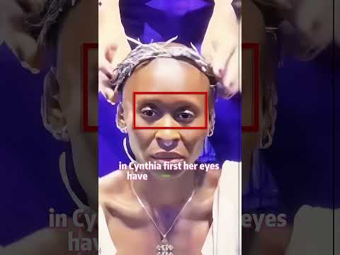 Why does Cynthia Erivo suddenly look like she's aged 20 years? #cynthiaerivo #entertainment