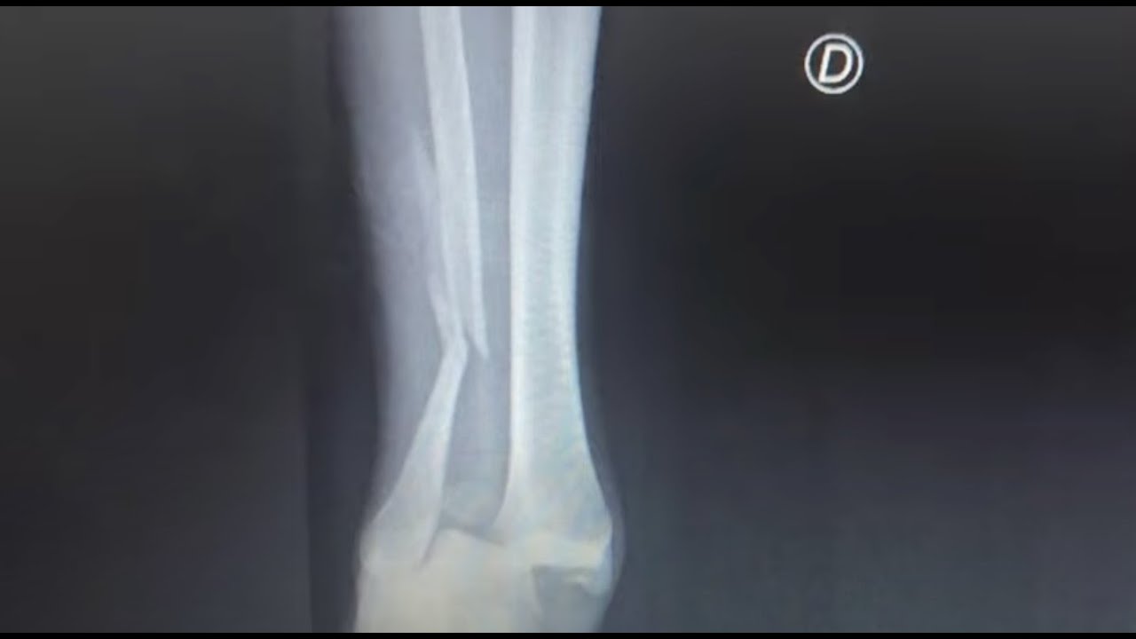 La historia de Gabriel Ribeiro