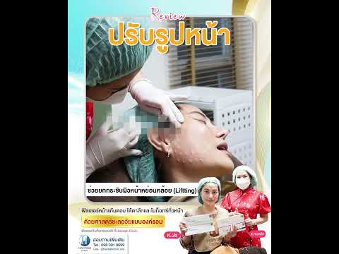 รีวิวหัตถการโปรแกรมปรับรูปหน้าแบบองค์รวม