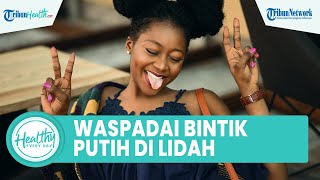 Waspadai Alami Bintik Putih di Lidah Bisa Jadi Tanda Gangguan Sistem Kekebalan Tubuh Jangka Panjang