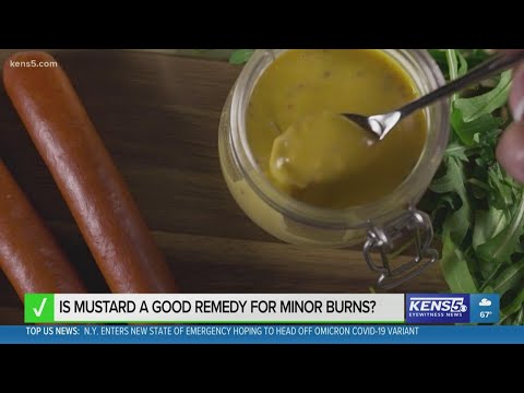 VERIFY: Is mustard a good remedy for minor burns?