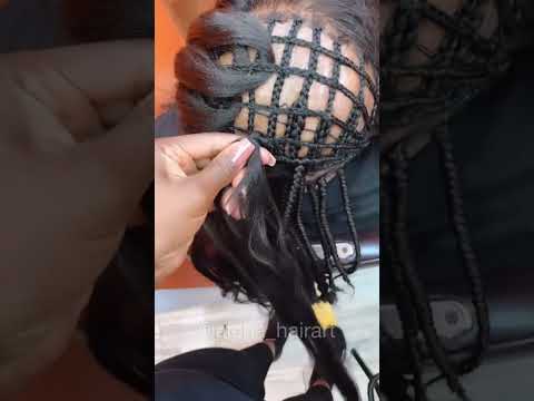 This Amazing Alopecia Transformation Shows How Anyone Can Have Beautiful Hair Again!