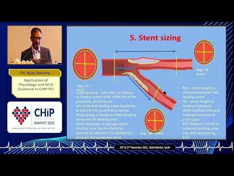 16  Dr Ajay Swamy    Application of Physiology and IVUS Guidance in CHIP