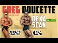 Here's Why I Think Greg Doucette Is Wrong About Me (Again) || Bodyfat % Comparisons