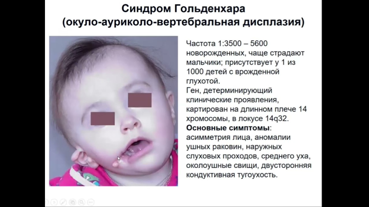 Слуховой анализатор 1