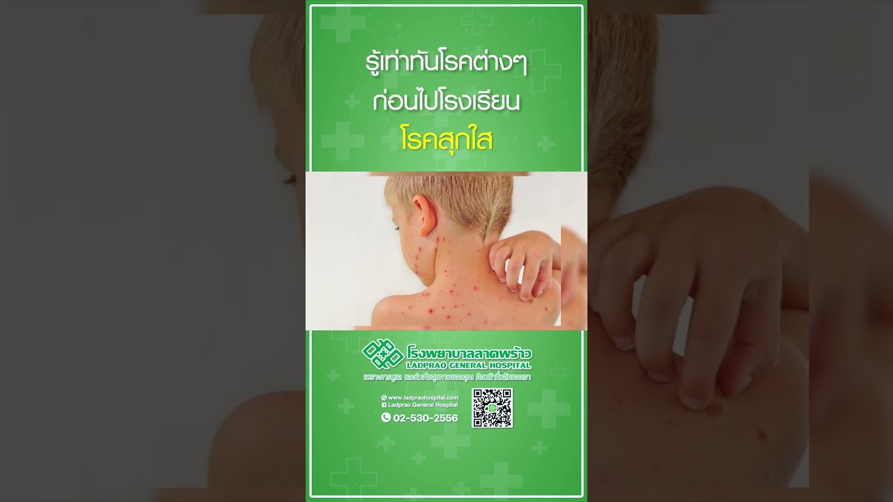 รู้ทันโรคก่อนไปโรงเรียน "โรคสุกใส"  #โรคสุกใส #โรคอีสุกอีใส #โรงพยาบาลลาดพร้าว