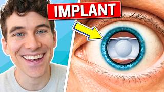 I Got Evo Icl Eye Surgery - Here's What Happened