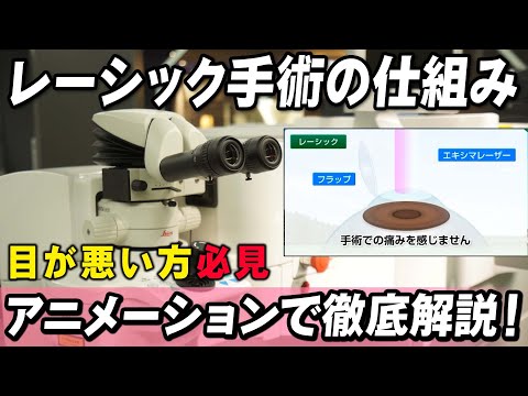 レーシックについて詳しく解説