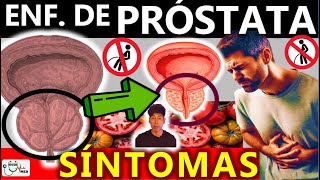 PROSTATA INFLAMADA EN ADULTOS MAYORES | GuiaMed