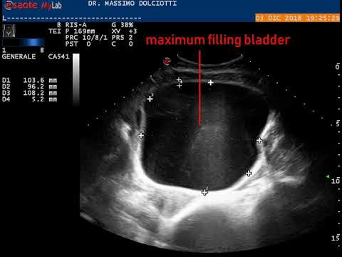 Vescica femminile a massimo riempimento