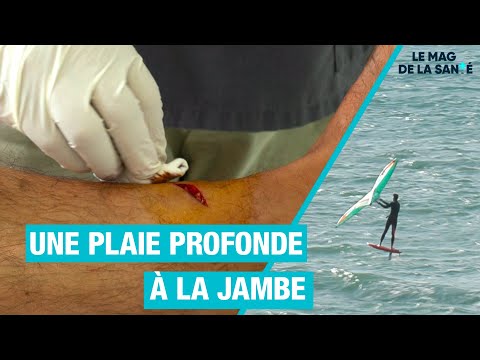 🚨 Il s’est OUVERT la jambe profondément 5/5 - Allo Docteurs