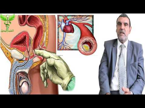 BPH-Behandlung Fokusin Alpha Pillen Prostatitis Preis