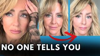My Deep Plane Facelift Regrets and Honest Results MQDEFAULT Thumbnail