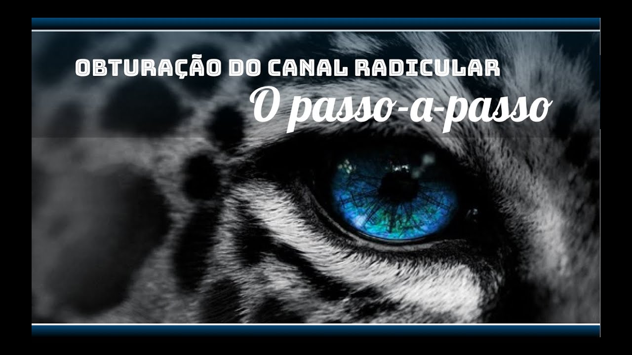 O passo a passo da Obturação do Canal Radicular | HELDER FERNANDES