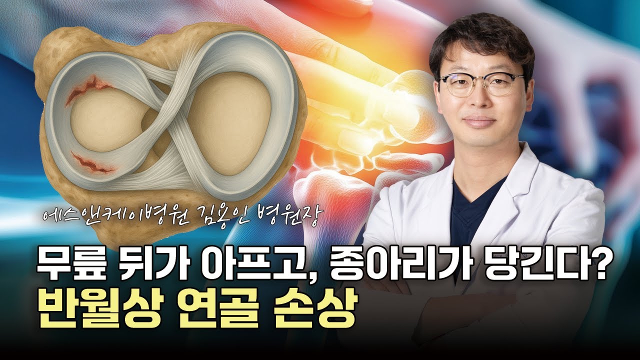 갑자기 움직이다가 무릎 뒤가 아프고, 종아리가 당긴다면? 반월상연골파열