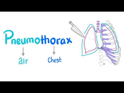 Pneumothorax - Spontaneous vs Tension Pneumothorax - Lung Physiology - Pulmonary Medicine