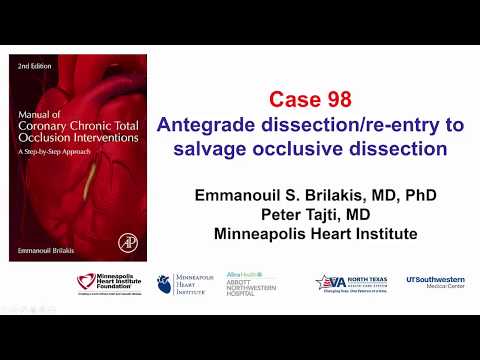 Case 98: Manual of CTO Interventions: Re-entry to recanalize a dissected vessel