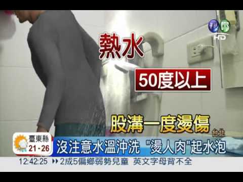 蓮蓬頭沖洗臀部 燙傷股溝起水泡