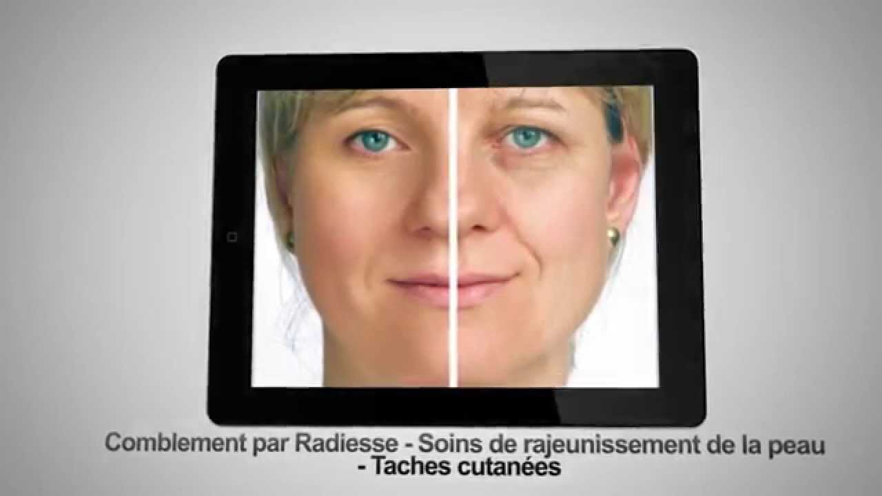 Watch video Médecine esthétique La Roche sur Yon Médecine esthétique La Roche sur Yon