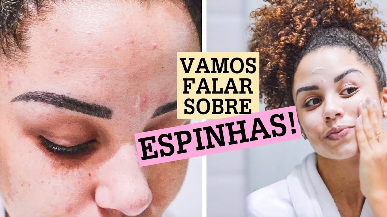 COMO CUIDO DAS MINHAS ESPINHAS: produtos, truques, autoestima...