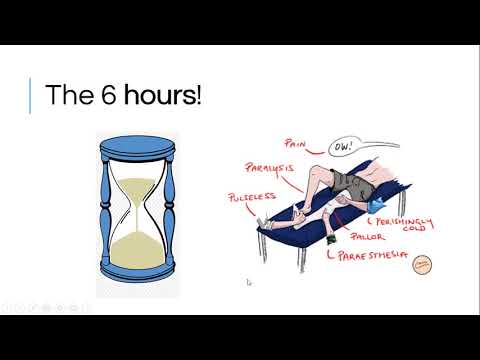 OSCE Masterclass 7: Approach to peripheral arterial and vascular examination