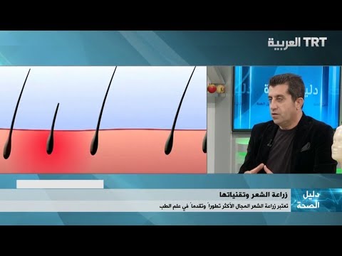 ما هي  الفترة اللازمة  للأستارحة ما بعد زراعة الشعر ؟