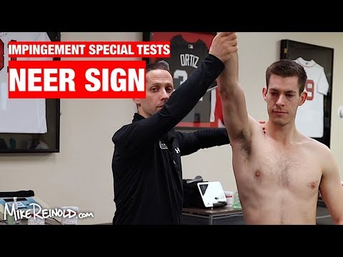 Neer Sign – Shoulder Rotator Cuff Impingement Special Test