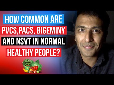 How common are PVCs, PACs, NSVT and Bigeminy in otherwise completely healthy normal people