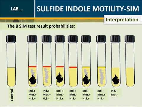 Sulfide Indole Motility (SIM) medium test