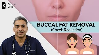 CHEEK FAT REDUCTION | Get Thin Cheeks with BUCCAL FAT REMOVAL SURGERY-Dr.Srikanth V| Doctors