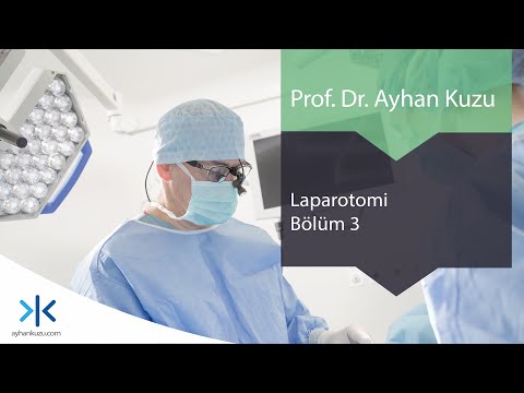 Laparotomi: Bölüm 3