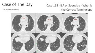 Case of the Day - 118 - 2025 10 14 - ILA or Sequelae: What is the Correct Terminology