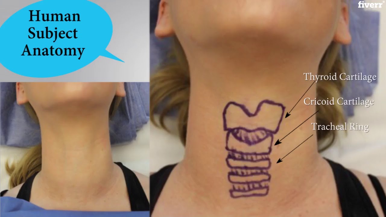 Cricoid Pressure Technique