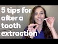 5 Things To Do After Your Tooth Is Extracted